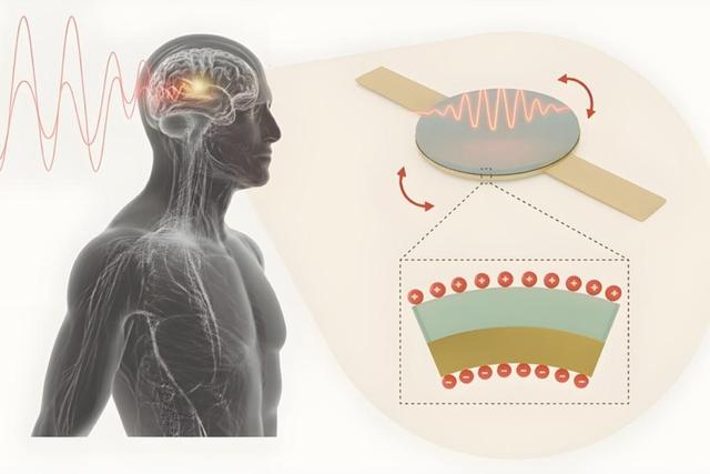 پایان باتری و آغاز ایمپلنت‌های بی‌سیم در جراحی پزشکی