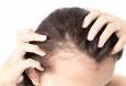 درمان ریزش مو با تغییر در چهار عادت