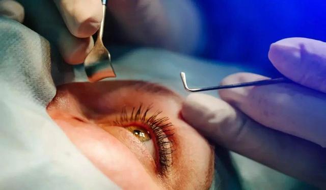 شیوع بالای آب‌سیاه مادرزادی در ایران | درمان تنبلی چشم باید قبل از ۷ سالگی پیگیری شود