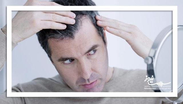 ۴ عادت ساده برای حفظ سلامت و جلوگیری از ریزش مو