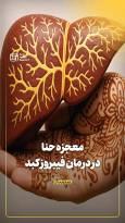 معجزه حنا در درمان فیبروز کبد
