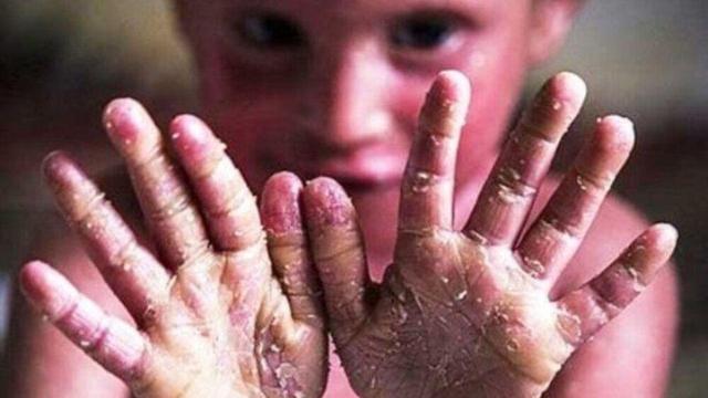 وقتی بال‌های پروانه شکست‌ناپذیر می‌شود