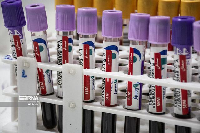 تفسیر نتایج آزمایش‌های پزشکی باید فقط توسط پزشکان انجام شود، نه هوش مصنوعی