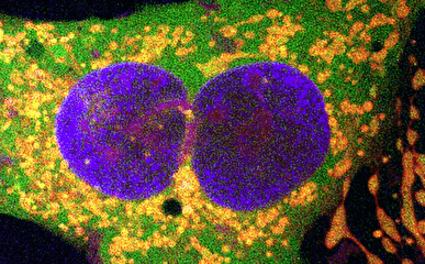 فناوری جدید ویرایش ژن نویدبخش درمان بیماری‌های پیچیده ژنتیکی است