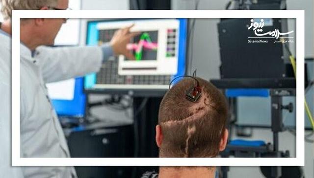 کاشت رابط مغز و رایانه در بیمار مبتلا به فلج کامل برای نخستین‌بار در اروپا