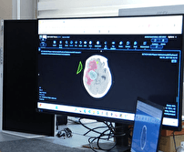 تولید سامانه دستیار پزشک، دستاود محققان ایرانی