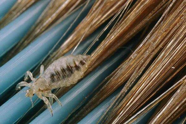 راهکارهای موثر برای از بین بردن شپش سر