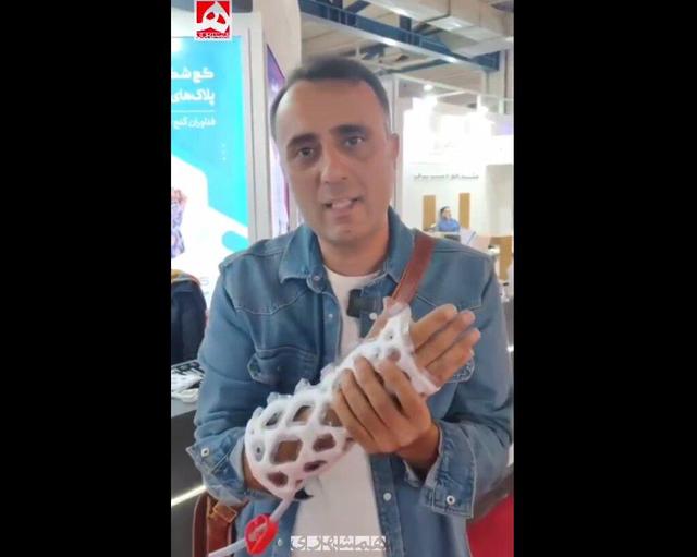 تولید گچ سبک برای شکستگی با مواد نانو + ویدئو | اختراع جدید جوانان ایرانی