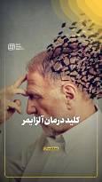 کلید درمان آلزایمر