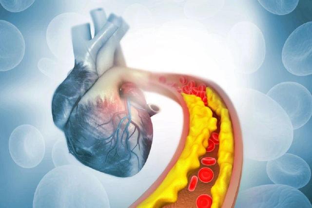 کاهش چربی خون با کمک ویرایش ژن برای اولین بار
