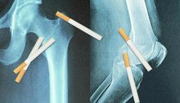استخوان‌ها سیگارهایی را که دود کرده‌اید به خاطر می‌سپارند