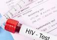 آغاز پویش «من هم تست HIV می‌دهم»
