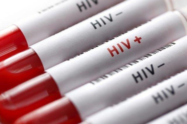 «مصرف تفننی مواد» و «رفتارهای جنسی پرخطر» عامل اصلی افزایش ریسک HIV