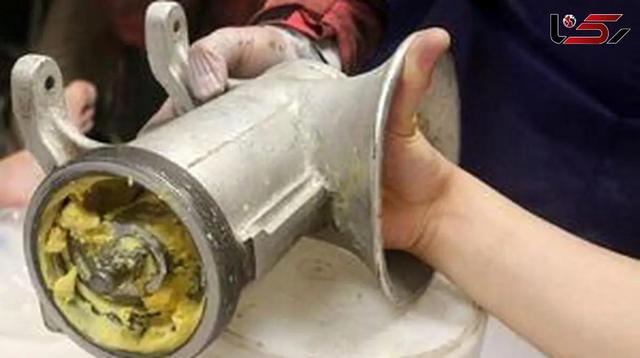 مجروح شدن دست کودک 1.5 ساله بر اثر گیر کردن در چرخ‌گوشت