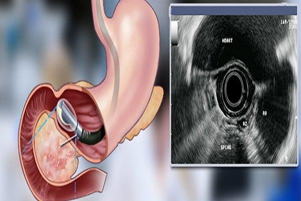 داورنیا: بیمارستان امام خمینی (ره) اردبیل به اندوسونوگرافی مجهز شد