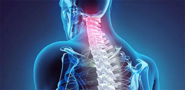 افزایش موارد دیسک گردن در میان جوانان