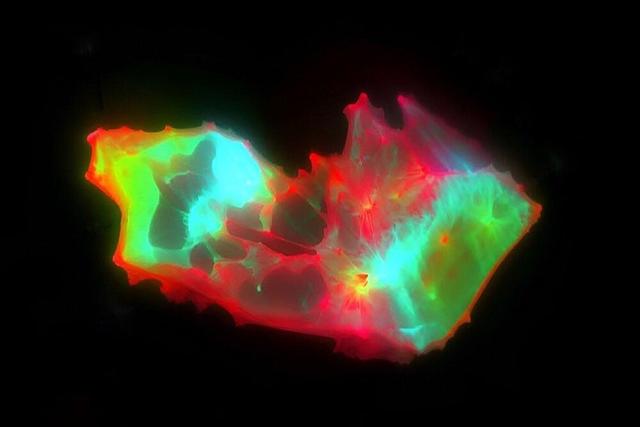 کشف ساختارهای عجیب و غریب در خون افراد مبتلا به کووید طولانی‌مدت