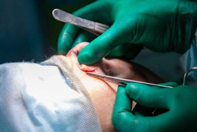 جراح زیبایی اینستاگرامی باعث طلاق چندین زن شد! | ماجرای جراحی بینی بدون بیهوشی توسط دستیار دیپلمه