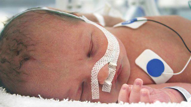 ۱۰.۵ درصد از نوزادان همدان نارس هستند