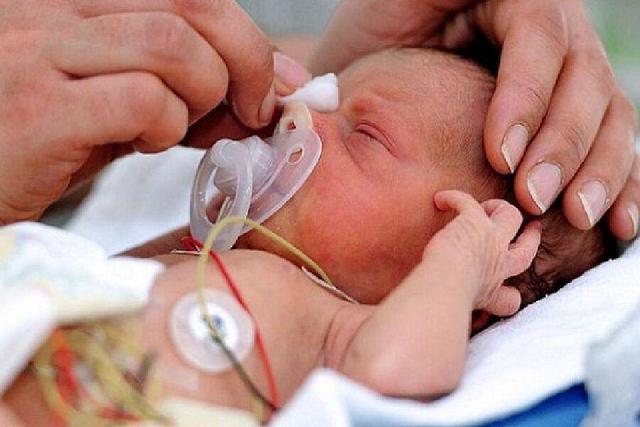 مراقبت ویژه، تنها راه حفظ جان نوزادان نارس است