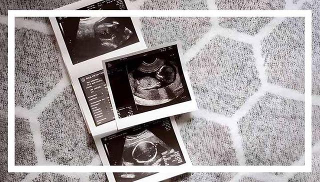 مراقبت های سه ماهه دوم بارداری؛ توصیه‌های کلیدی متخصصان برای سلامت مادر و جنین