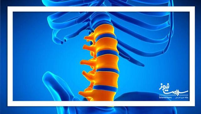 ترمیم شکستگی‌های ستون فقرات با سلول‌های بنیادی چربی؛ امیدی تازه برای بیماران پوکی استخوان
