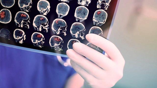 هشدار درباره پایین آمدن سن بروز سرطان در خوزستان/ تمرکز بر غربالگری از ۲۵ سالگی