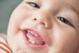 دندان‌ این نوزادان زودتر درمی‌آید