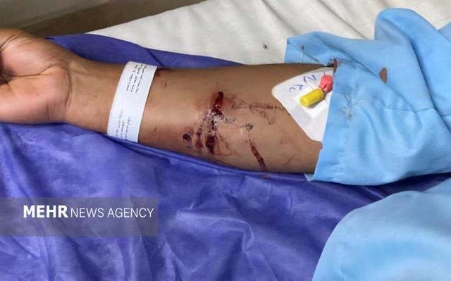 دادستان فومن: برخی گروه‌ها مانع ساماندهی سگ‌ های ولگرد می‌شوند