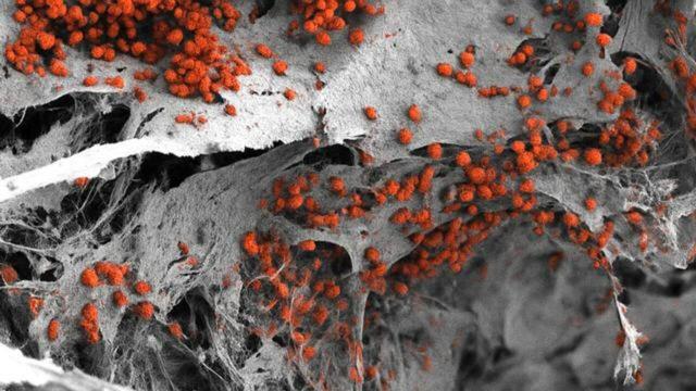 کارخانه خون‌سازی مغز استخوان انسان در آزمایشگاه ساخته شد