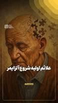 علائم اولیه شروع آلزایمر