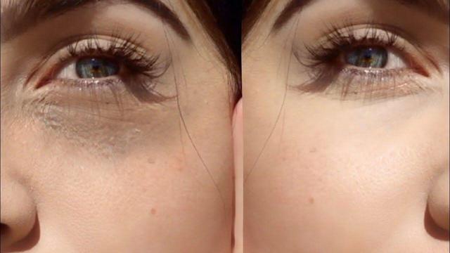 راهکار های کاهش تیرگی و پف دور چشم در خانه