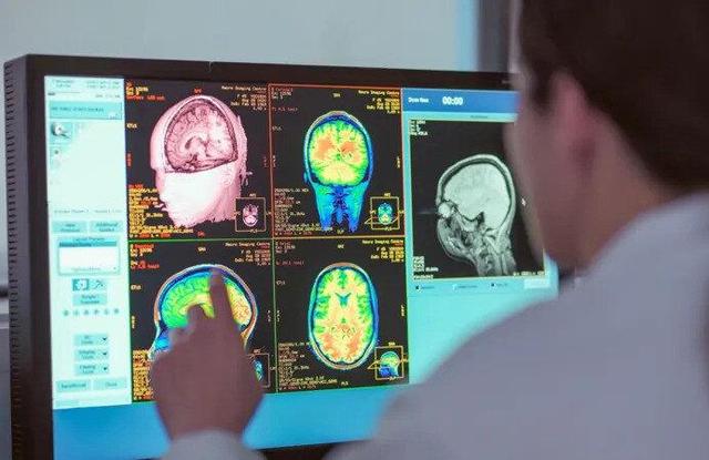 مغزتان تا ۳۰ سالگی هم می‌تواند نوجوان باشد!