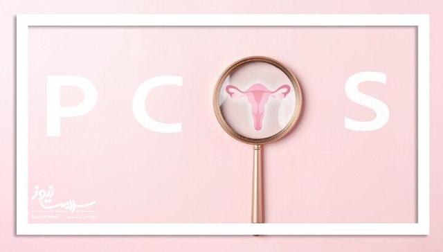 ۶ راهکار ساده و مؤثر برای مدیریت علائم PCOS