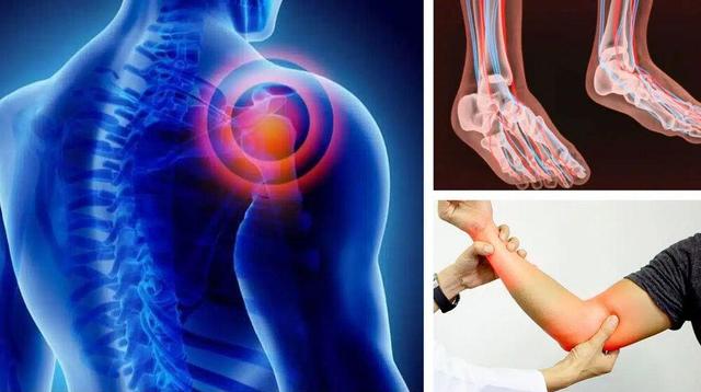 شانه یخ‌زده، بیماری که حرکت را محدود می‌کند