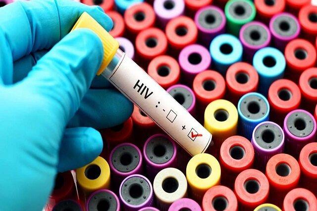 رئیس مرکز بهداشت استان قم: باورهای نادرست درباره راه‌های انتقال HIV اصلاح شود