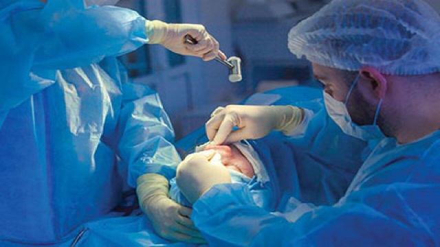 چرا شیادها در بازار جراحی زیبایی کاسبی‌شان پر رونق است؟