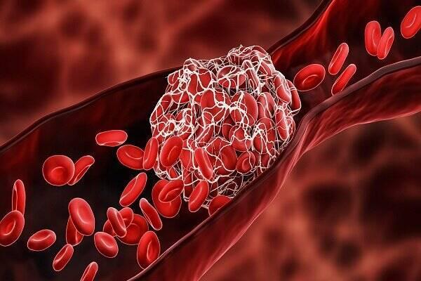 دشمن خاموش رگ‌ها