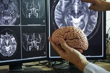 مغز انسان در چهار مقطع کلیدی عمر، بازسازمان‌دهی می‌شود