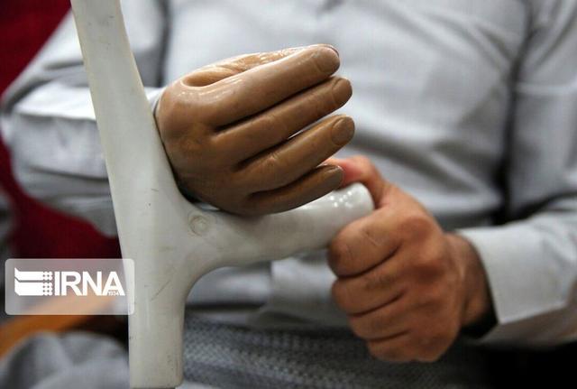 پرداخت حق پرستاری معلولان خراسان رضوی ۵۰۰ میلیارد ریال در ماه است