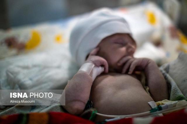 ناهنجاری‌های بدو تولد اولین عامل مرگ کودکان زیر 5 سال