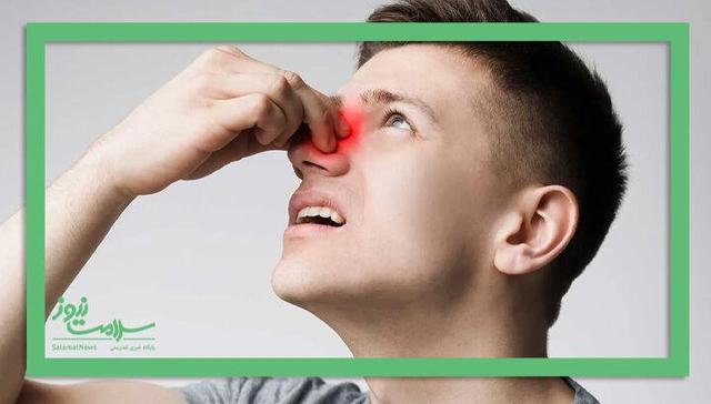 علائم و نشانههای پولیپ بینی