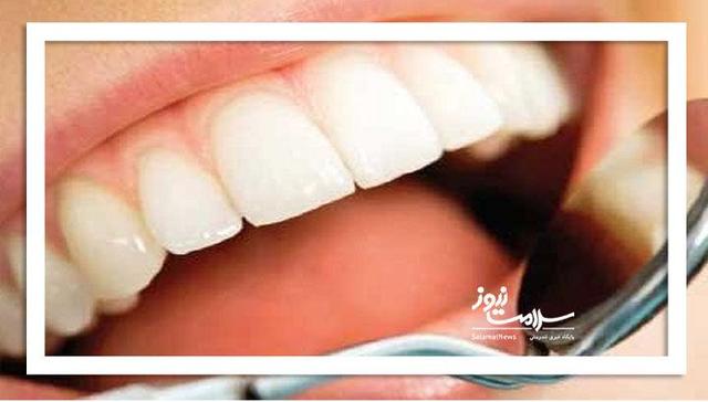 جرم‌گیری؛ درمانی ساده، بی‌ضرر و کلیدی برای سلامت دهان