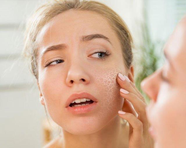 شیرینی پرطرفداری که پوست را تیره و پیر می‌کند