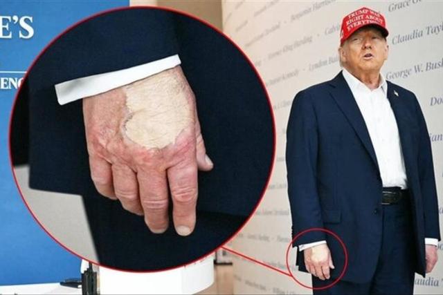 واکنش عجیب کاخ سفید به تصاویر بانداژ روی دست ترامپ