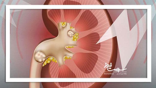 چگونه هوای کلیه‌ها را داشته باشیم