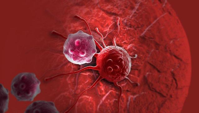 سرطان پستان در ایران رو به افزایش است