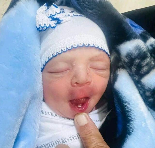 نوزاد عراقی با دندان به دنیا آمد