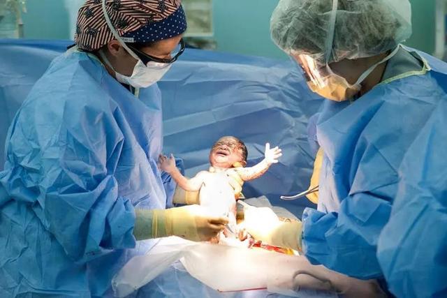 تولد یک نوزاد با دندان