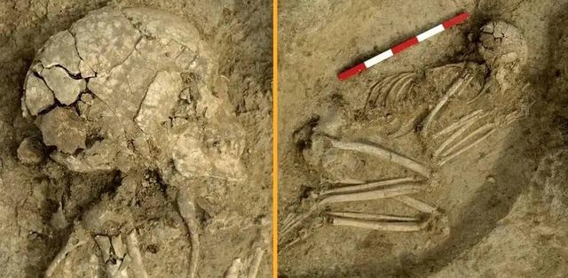 فرو رفتن دندان شیر در جمجمه یک نوجوان + عکس | اسکلت ۶ هزار سال قبل را ببینید